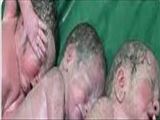 تولد سه قلوها در مرکز